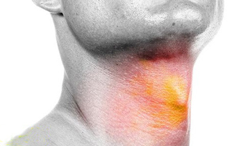 生活中哪些因素容易引发喉癌？