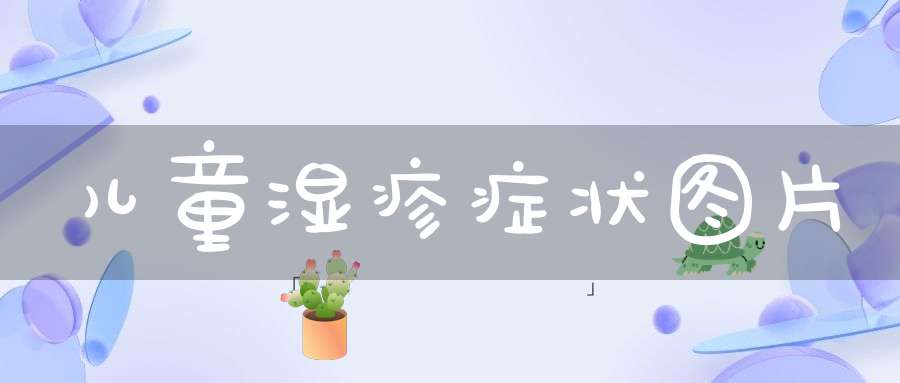 儿童湿疹症状图片(这些湿疹症状,你家宝宝遇到过么?)