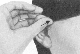 冠心病按摩