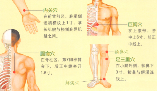 呃逆艾灸