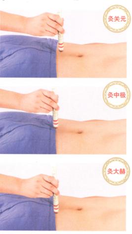 不育症艾灸