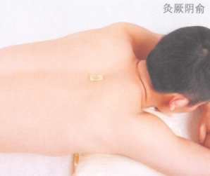心律失常艾灸