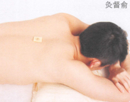 低血压艾灸