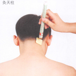 落枕艾灸
