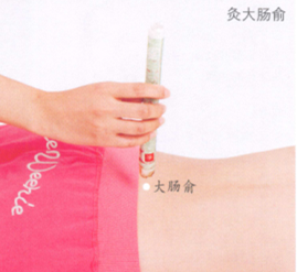 外阴瘙痒症艾灸