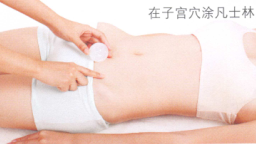 子宫肌瘤艾灸