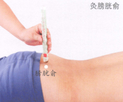 阳痿艾灸