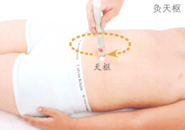 小儿腹泻艾灸