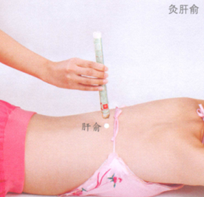 黄褐斑艾灸