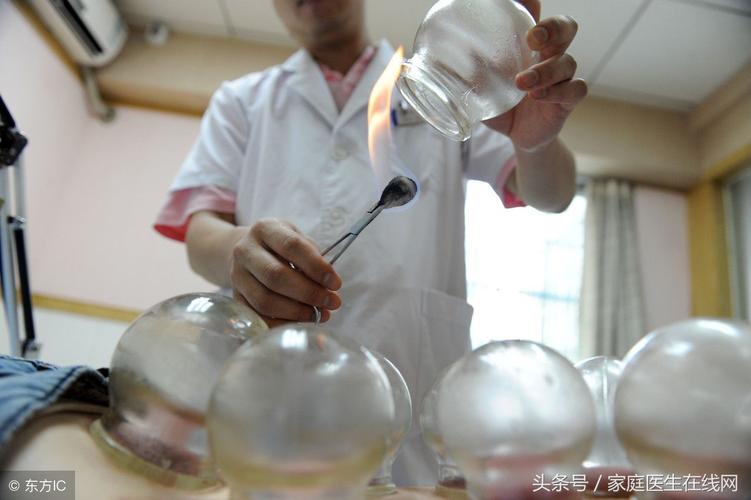 有人说拔罐会伤元气这是真的吗？