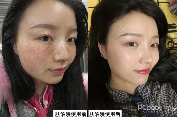 目前最安全的祛斑方法，如何正确祛斑