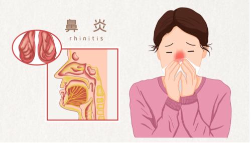 鼻炎怎么办食疗就是治疗鼻炎的偏方
