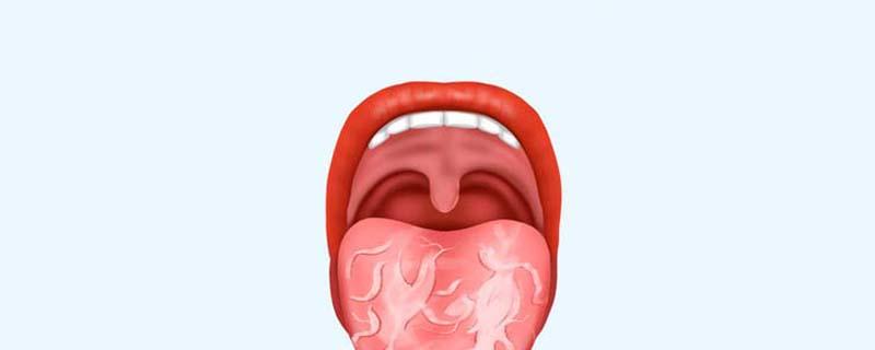 地图舌能喝酒吗 地图舌喝什么好