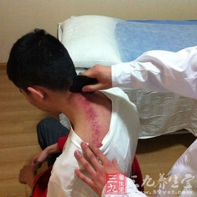 亚健康状态的刮痧调理