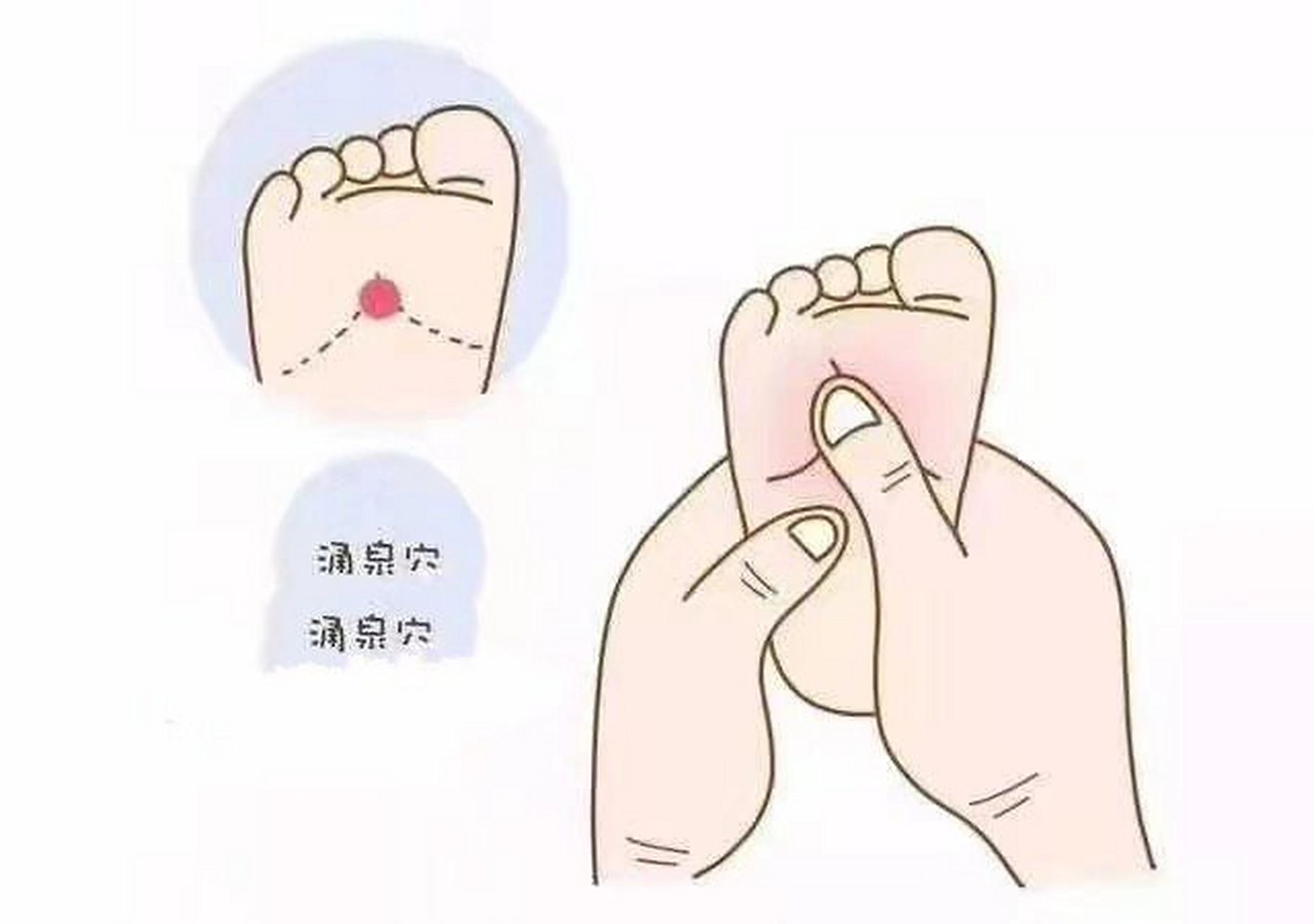 推拿涌泉穴.jpg