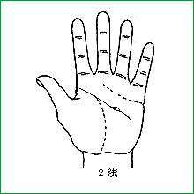 智慧线中指下2-3个小岛纹