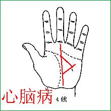 健康线长到感情线里