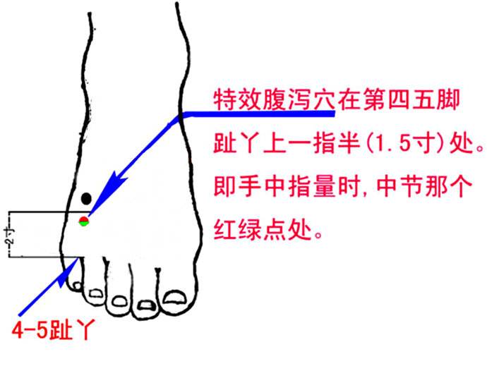 腹泻特效穴www.zgmjyxw.com