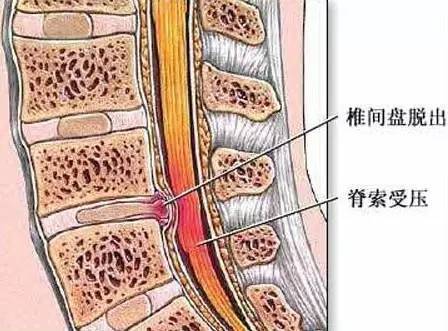 解决脖子一转就响的方法