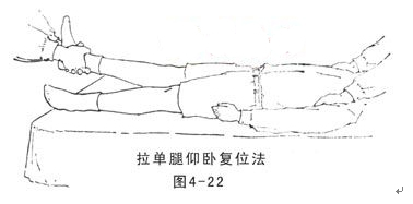 治疗腰椎间盘突出的一次性复位法
