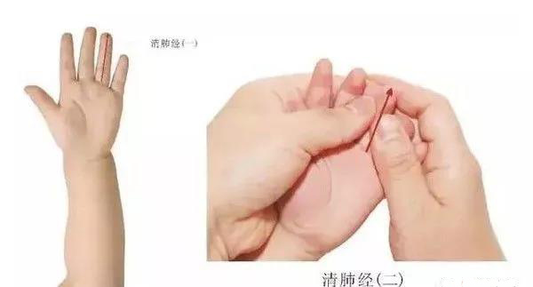 小儿治病穴位推拿方法