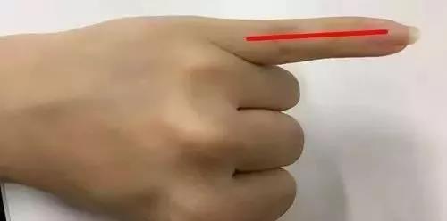 常刮手指能治人体疾病