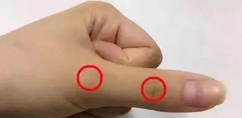 常刮手指能治人体疾病