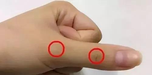 常刮手指能治人体疾病