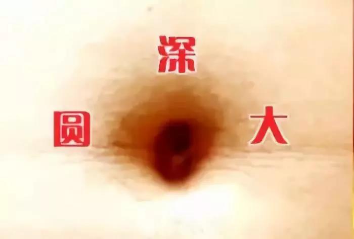 按肚脐知五脏疾病