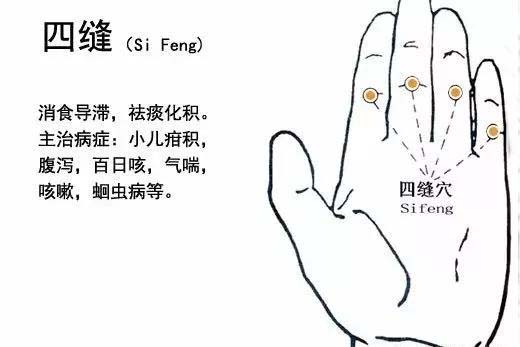 治小儿积食常用的四缝穴