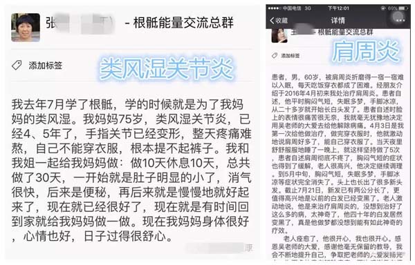 根骶手法——调理肛门的手法
