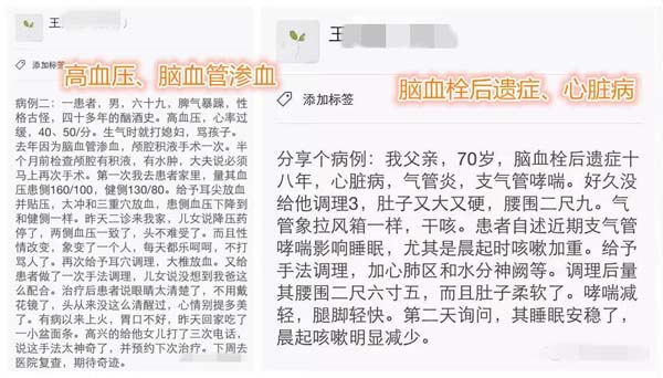 根骶手法——调理肛门的手法