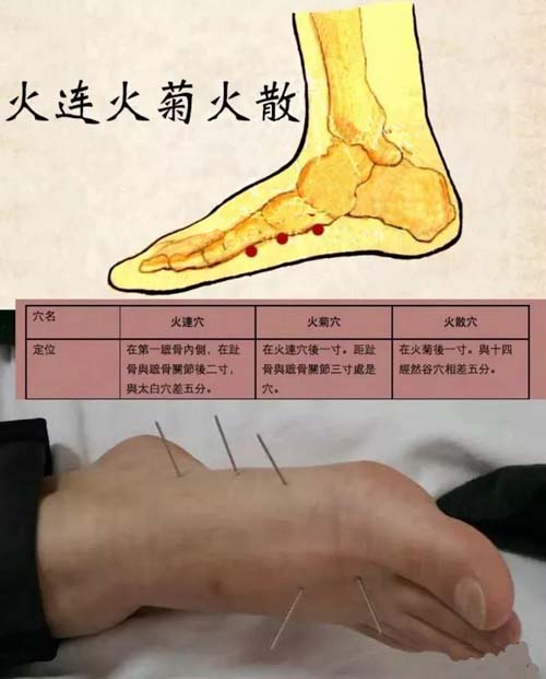 火菊火連火散
