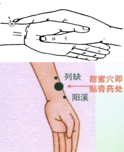 列缺穴