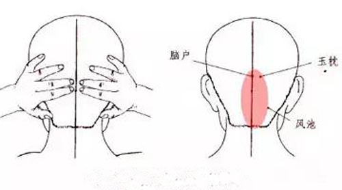 脑户