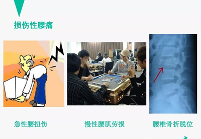 腰痛的针灸治疗