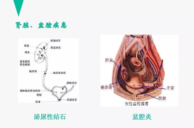腰痛的针灸治疗