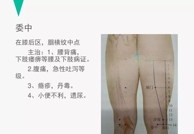 腰痛的针灸治疗