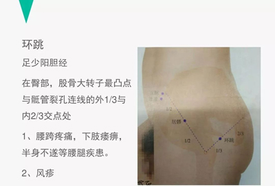 腰痛的针灸治疗