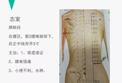 腰痛的针灸治疗