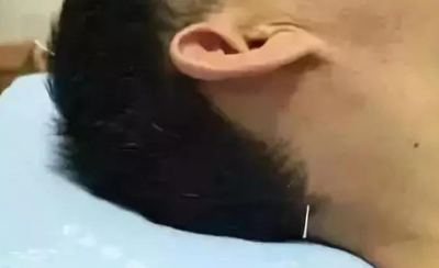 风池