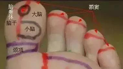 痴呆线