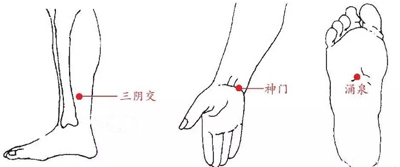 涌泉穴、神门穴、三阴交穴