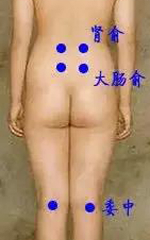 腰三针