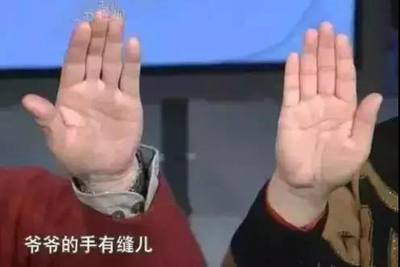 检查肝胆好坏的方法