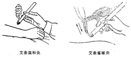 温和灸，雀啄灸