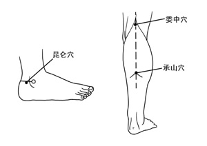 昆仑穴、承山穴、合阳穴、委中穴