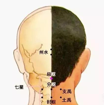 三叉神经痛