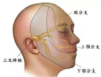 三叉神经