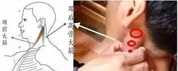 耳后高骨下大筋